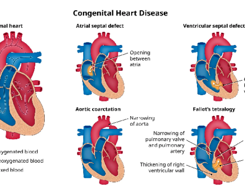 Congenital Heart Defect Awareness Week: Raising Awareness and Understanding 